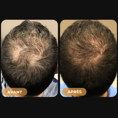 (FR) Hairzen Hair Root Shampoo
