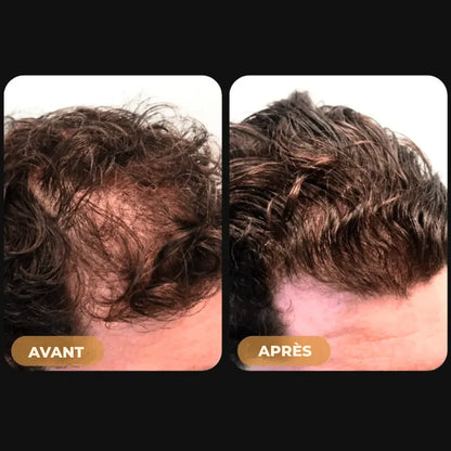 (FR) Hairzen Hair Root Shampoo