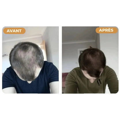(FR) Hairzen Hair Root Shampoo
