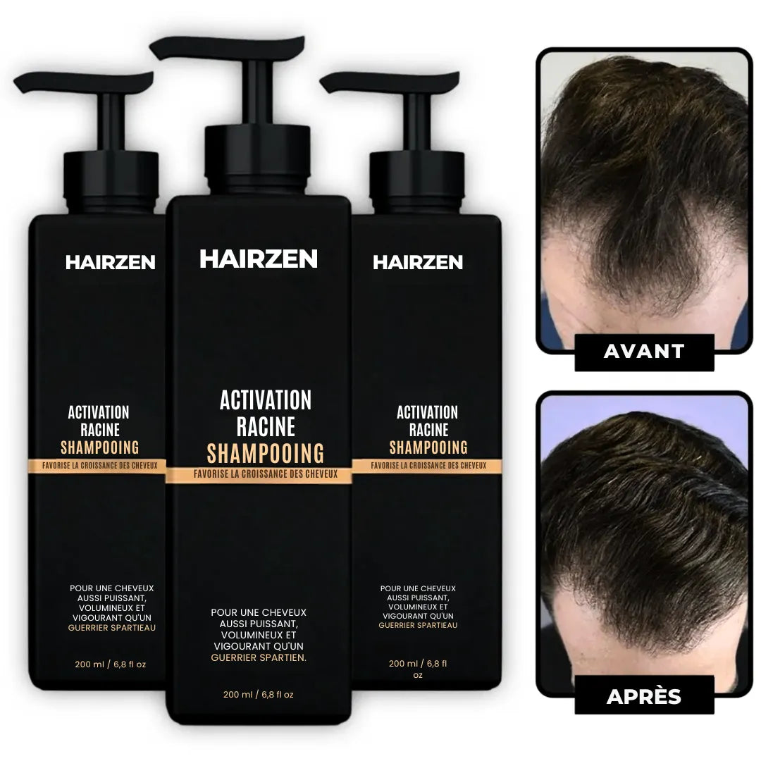 (FR) Hairzen Hair Root Shampoo