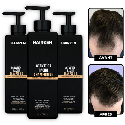 (FR) Hairzen Hair Root Shampoo