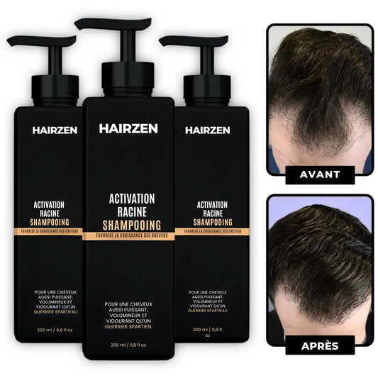 (FR) Hairzen Hair Root Shampoo